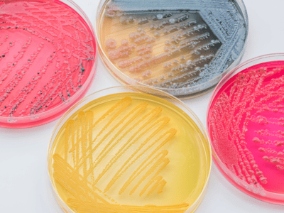 Bacterial-culture-agar-plate-complex-media