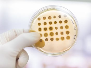 fungal-cell-agar-plate-inoculation