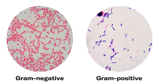 gram-nagative-positive-bacteria